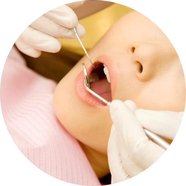 PMTC（プロフェッショナル・メカニカル・トゥース・クリーニング） 歯の掃除
