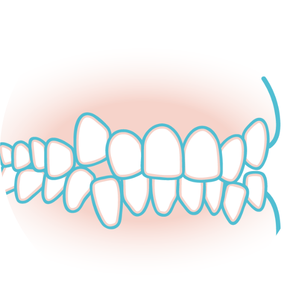 大人の矯正治療 大阪豊中市の歯科矯正治療 なかすじ矯正 小児歯科クリニック